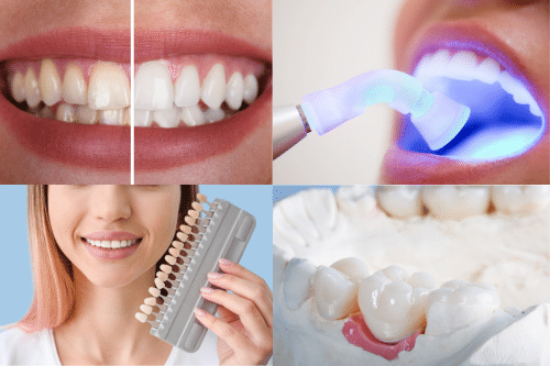 cosmetic dental
